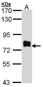 Btk Antibody in Western Blot (WB)