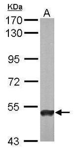 ABAT Antibody in Western Blot (WB)