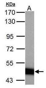 ABAT Antibody in Western Blot (WB)