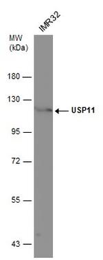 USP11 Antibody in Western Blot (WB)