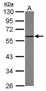 KLF4 Antibody in Western Blot (WB)