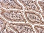 PABP Antibody in Immunohistochemistry (Paraffin) (IHC (P))