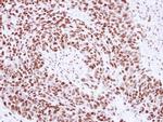 SNRPA Antibody in Immunohistochemistry (Paraffin) (IHC (P))