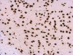 SNRPA Antibody in Immunohistochemistry (Paraffin) (IHC (P))