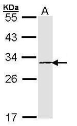 PSMB4 Antibody in Western Blot (WB)