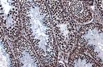 hnRNP K Antibody in Immunohistochemistry (Paraffin) (IHC (P))