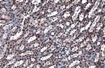 hnRNP K Antibody in Immunohistochemistry (Paraffin) (IHC (P))