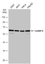 hnRNP K Antibody in Western Blot (WB)