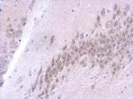 FUS Antibody in Immunohistochemistry (Paraffin) (IHC (P))