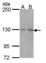 NYREN18 Antibody in Western Blot (WB)