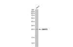 SNRPB Antibody in Western Blot (WB)