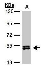 RPS6KB2 Antibody in Western Blot (WB)