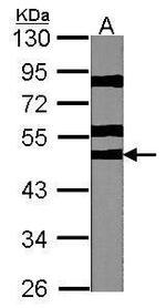 RPS6KB2 Antibody in Western Blot (WB)