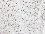 LZIP Antibody in Immunohistochemistry (Paraffin) (IHC (P))