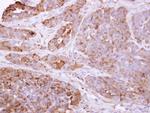 Talin 1 Antibody in Immunohistochemistry (Paraffin) (IHC (P))