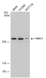 Talin 1 Antibody in Western Blot (WB)