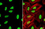 TRIM28 Antibody in Immunocytochemistry (ICC/IF)