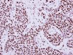 TRIM28 Antibody in Immunohistochemistry (Paraffin) (IHC (P))