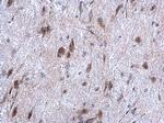 HYOU1 Antibody in Immunohistochemistry (Paraffin) (IHC (P))