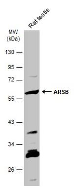 Arylsulfatase B Antibody in Western Blot (WB)