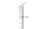 CDK4 Antibody in Western Blot (WB)