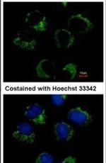 CAT1 Antibody in Immunocytochemistry (ICC/IF)