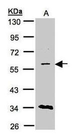 CAT1 Antibody in Western Blot (WB)