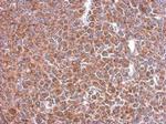 STIP1 Antibody in Immunohistochemistry (Paraffin) (IHC (P))