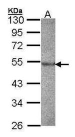 Cathepsin F Antibody in Western Blot (WB)