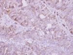 JNK3 Antibody in Immunohistochemistry (Paraffin) (IHC (P))