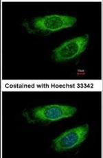 p70 S6 Kinase Antibody in Immunocytochemistry (ICC/IF)