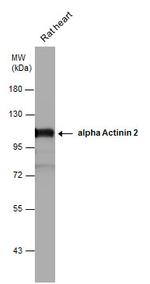 alpha Actinin 2 Antibody in Western Blot (WB)