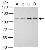 alpha Actinin 2 Antibody in Western Blot (WB)