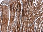 alpha Actinin 2 Antibody in Immunohistochemistry (Paraffin) (IHC (P))