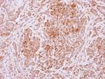 USP4 Antibody in Immunohistochemistry (Paraffin) (IHC (P))