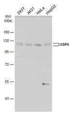 USP4 Antibody in Western Blot (WB)