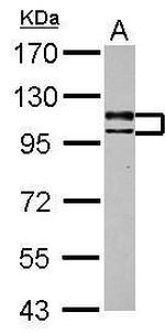 USP4 Antibody in Western Blot (WB)