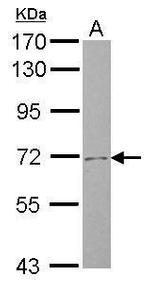 SLC4A8 Antibody in Western Blot (WB)