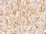 NMDAR2A Antibody in Immunohistochemistry (Paraffin) (IHC (P))