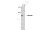 NMDAR2A Antibody in Western Blot (WB)