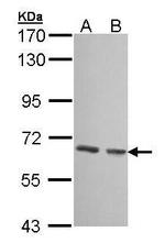 GCKR Antibody in Western Blot (WB)