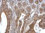 TPK1 Antibody in Immunohistochemistry (Paraffin) (IHC (P))