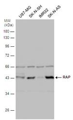 RAP Antibody in Western Blot (WB)