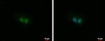 ITPKC Antibody in Immunocytochemistry (ICC/IF)