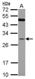 QDPR Antibody in Western Blot (WB)