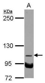 NDST3 Antibody in Western Blot (WB)