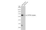 HTR1A Antibody in Western Blot (WB)