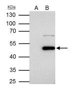 Flotillin 1 Antibody in Immunoprecipitation (IP)