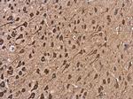 Kinesin 5A Antibody in Immunohistochemistry (Paraffin) (IHC (P))