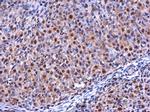 RGS2 Antibody in Immunohistochemistry (Paraffin) (IHC (P))